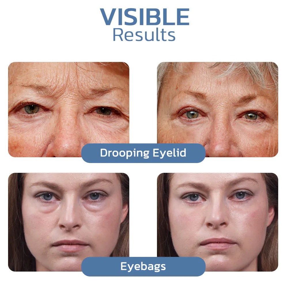 flysmus OPENEYES Awaken Peptide Lifting Eye Gel