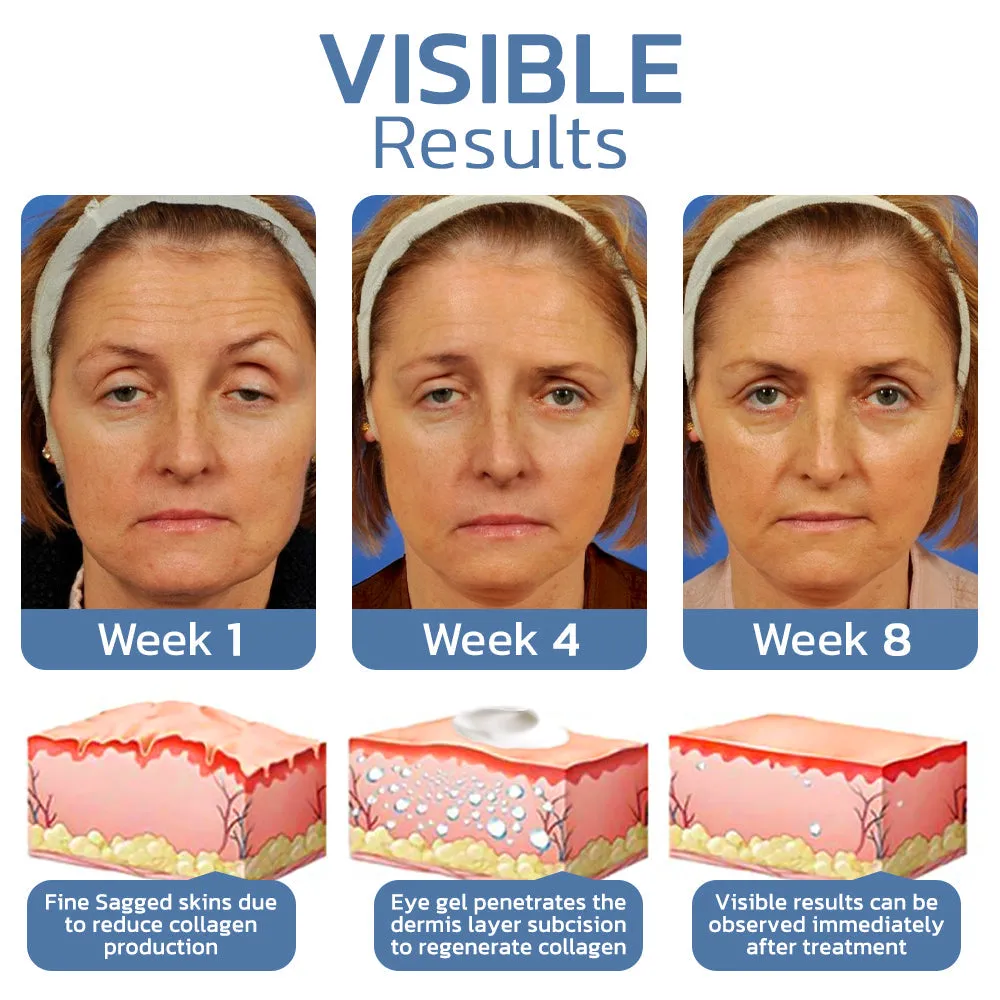 flysmus OPENEYES Awaken Peptide Lifting Eye Gel