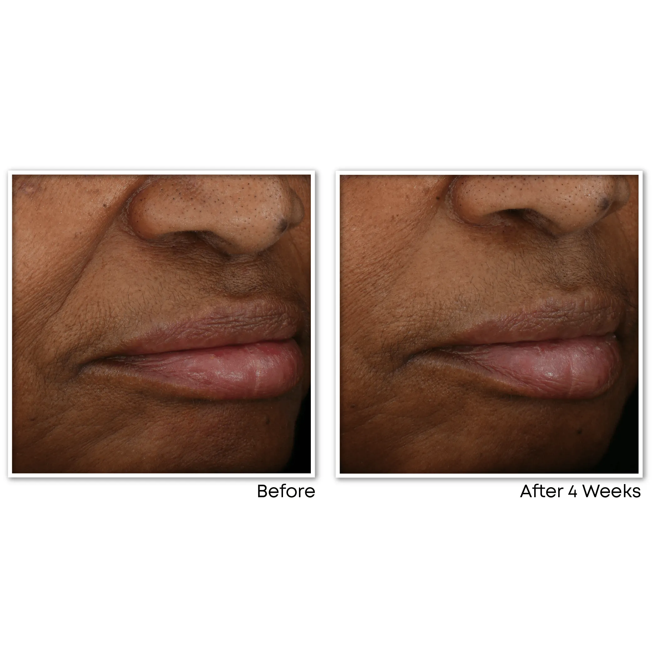 MULTI CORREXION® Revive   Glow Moisturizer